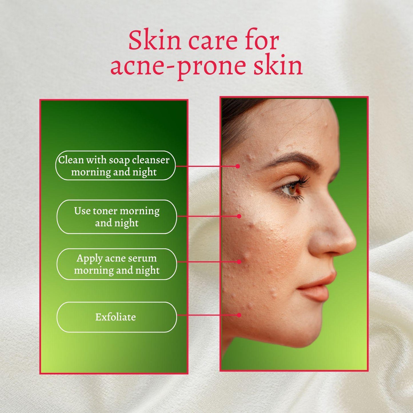 Perfect Trifecta Acne Peel