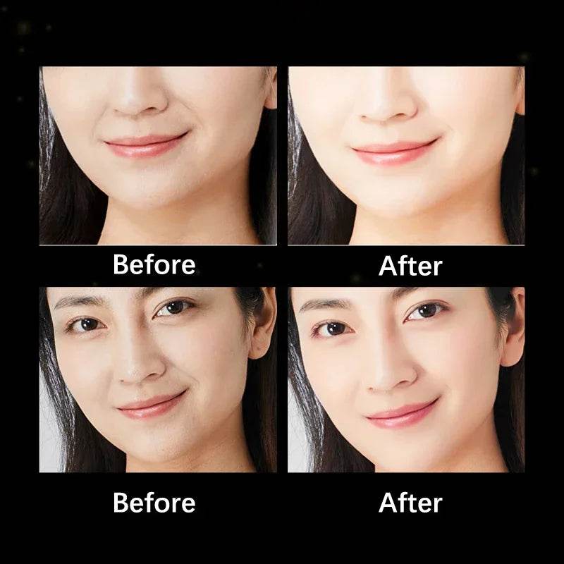 Youthful Glue-Free Lift Patches – Say Goodbye to Fine Lines!