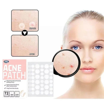 Acne Spot Healing Patches – Invisible Waterproof Stickers for Pimple Removal, Marks, and Scar Care