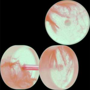 Glow in the Dark Two Tone Cheater Plug Set