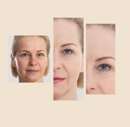 The Eraser Spot Cream | Dark Spot Corrector