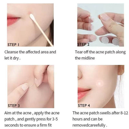 Acne Spot Healing Patches – Invisible Waterproof Stickers for Pimple Removal, Marks, and Scar Care