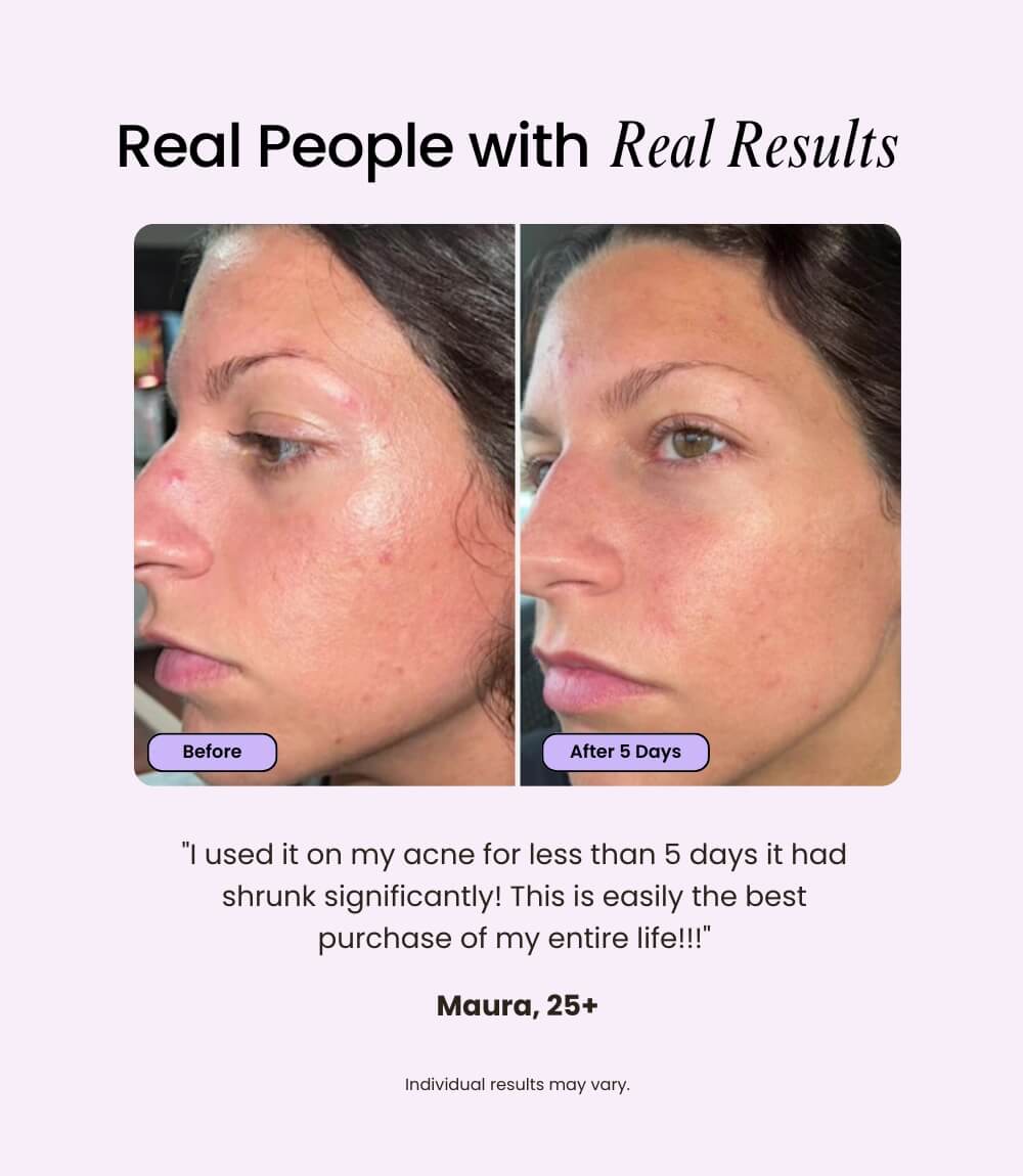 Velve Pro 5-in-1 Skincare Wand Complete Kit
